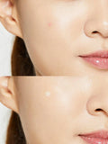 CosRx Acne Pimple Master Patch Pakistan
