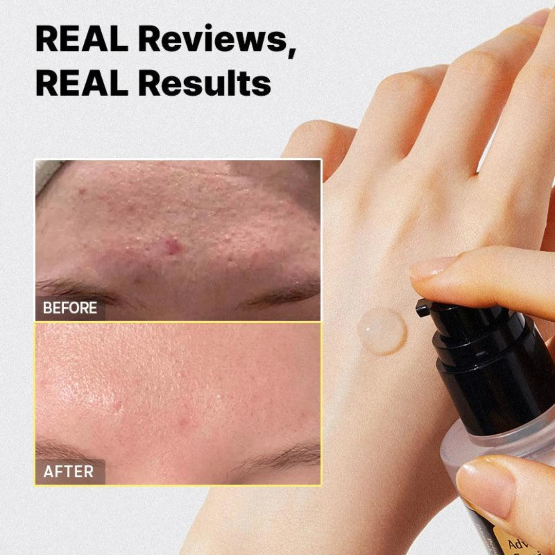 CosRx Advanced Snail 96 Mucin Power Essence 100ml Pakistan